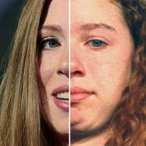 Zergnet Ad Example 67400 - Chelsea Clinton's Drastic Transformation