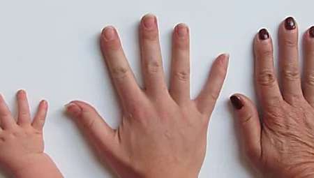 Outbrain Ad Example 52211 - Anzeichen Für Krebs: Achten Sie Auf Ihre Fingernägel!