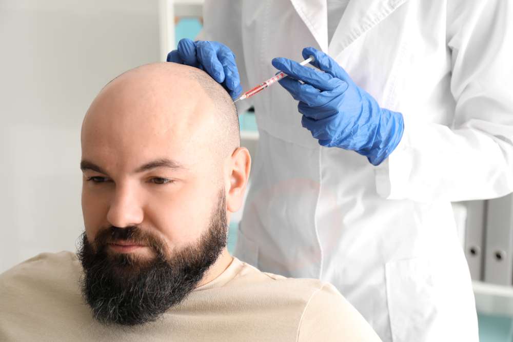 Taboola Ad Example 40441 - Hair Transplant Prices In Dubai Might Shock You