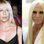Content.Ad Ad Example 46989 - Celebrity Plastic Surgery Disasters: Before-and-After Pics